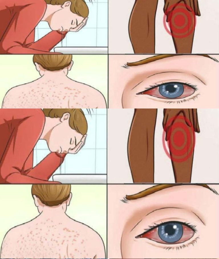 17 oznak choroby pleśniowej (i jak rozpoznać, czy jesteś narażony na ryzyko)