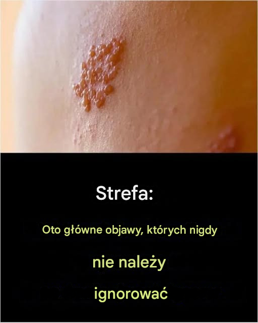 Półpasiec: objawy, powikłania i profilaktyka