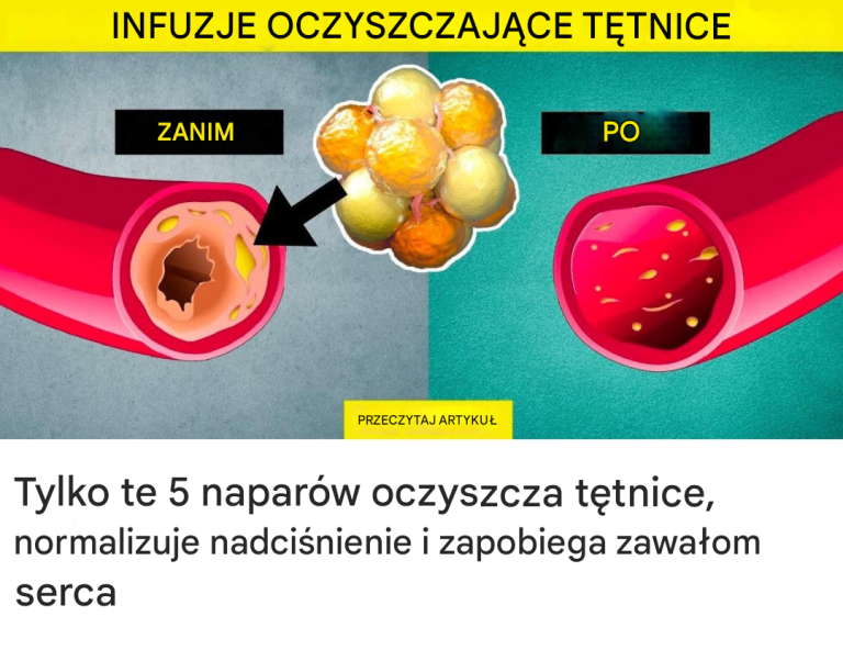 Tylko te 5 naparów oczyszcza tętnice, normalizuje nadciśnienie i zapobiega zawałom serca