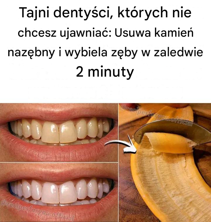 Tajemnica, której dentyści nie chcą, abyś poznał: Usuwa kamień nazębny i wybiela zęby w zaledwie 2 minuty