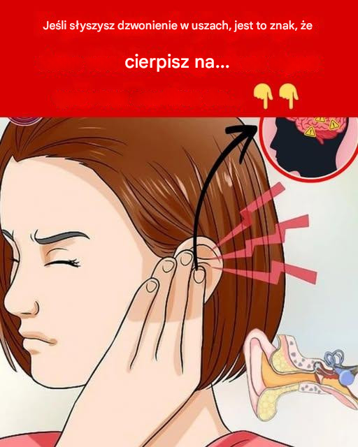 Jeśli słyszysz dzwonienie w uszach, jest to znak, że cierpisz na...