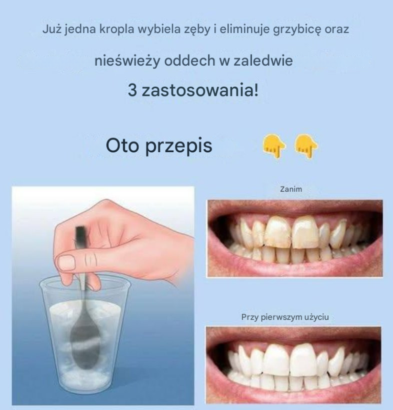 Usuń kamień nazębny i wybiel je dzięki temu prostemu przepisowi.