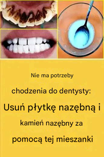 Nie musisz iść do dentysty: usuń płytkę nazębną i kamień nazębny za pomocą tej mieszanki