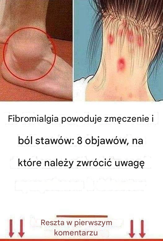 Fibromialgia powoduje zmęczenie i ból stawów: 8 objawów, na które należy zwrócić uwagę
