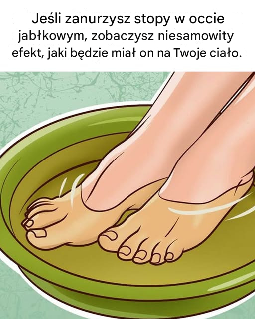 Dlaczego warto moczyć stopy w occie jabłkowym?