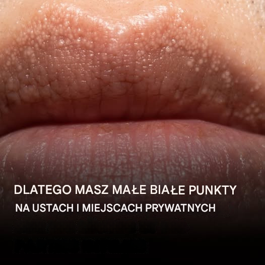 Oto powód, dla którego na ustach i częściach intymnych pojawiają się małe, białe kropki
