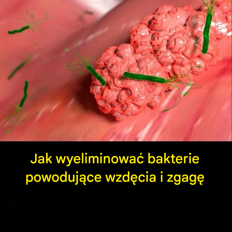 Jak naturalnie wyeliminować bakterie H. Pylori odpowiedzialne za zgagę i wzdęcia