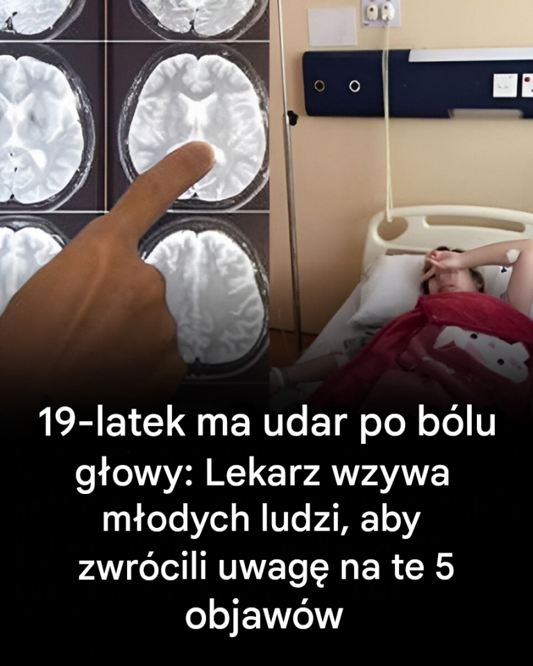 5 ostrzegawczych sygnałów udaru mózgu, na które należy zwrócić uwagę u młodych ludzi