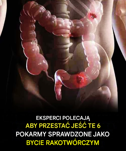 6 potencjalnie rakotwórczych produktów spożywczych, których należy unikać