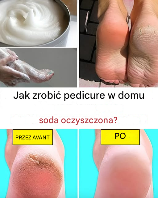 Jak zrobić pedicure w domu przy użyciu sody oczyszczonej?