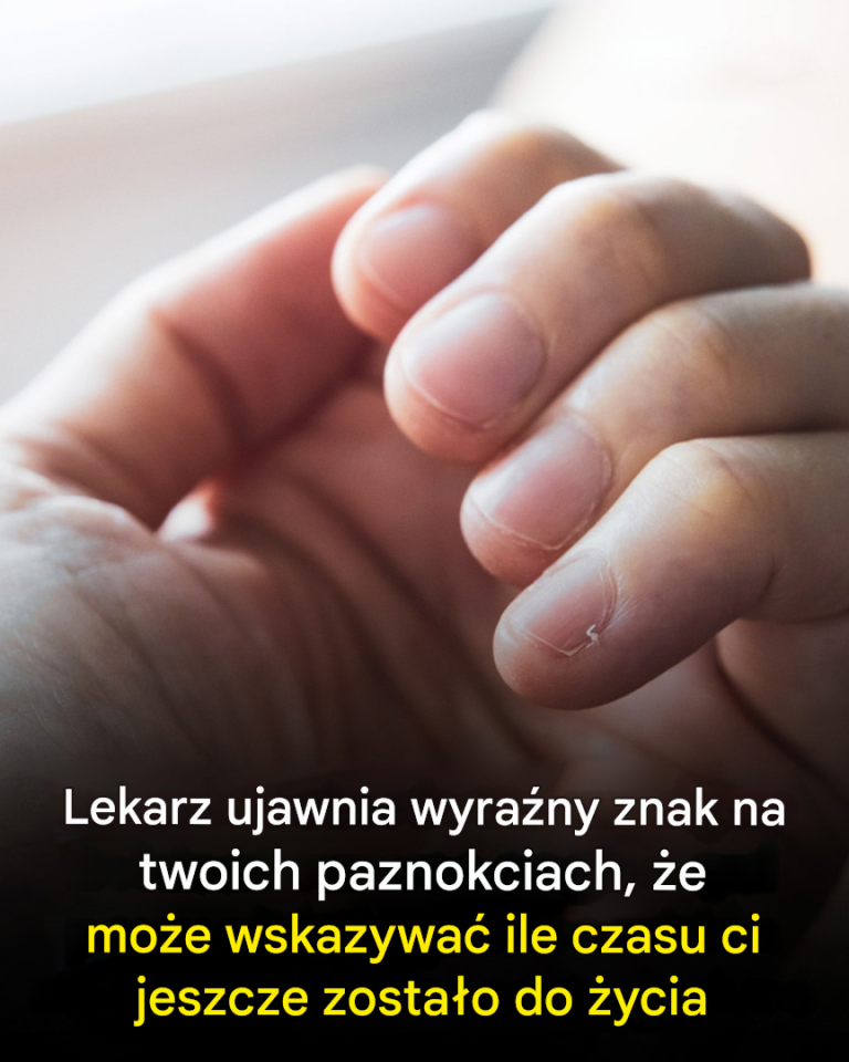 Lekarz ujawnił wyraźny znak na twoich paznokciach, który może wskazywać, ile czasu ci jeszcze zostało do życia