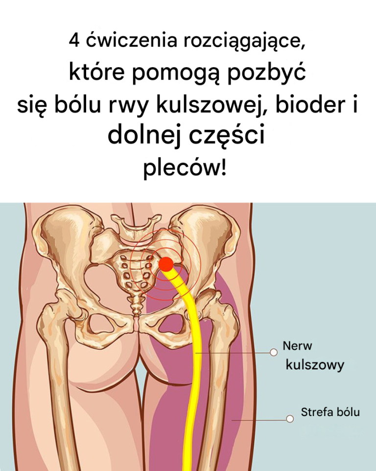 4 ćwiczenia rozciągające mięsień gruszkowaty i łagodzące ból rwy kulszowej i dolnej części pleców