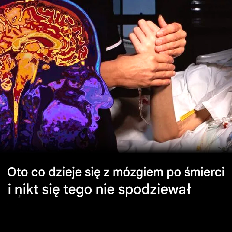 Niesamowita symulacja pokazuje, co dzieje się z naszym mózgiem w ciągu 10 minut od śmierci