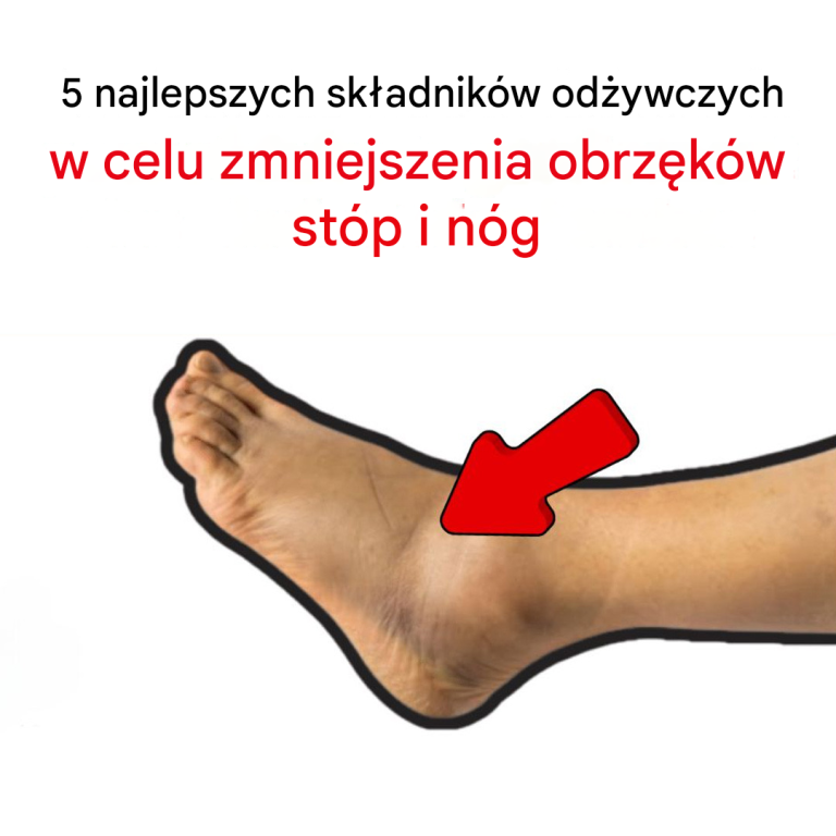 5 najlepszych składników odżywczych, które zmniejszają obrzęk stóp i nóg