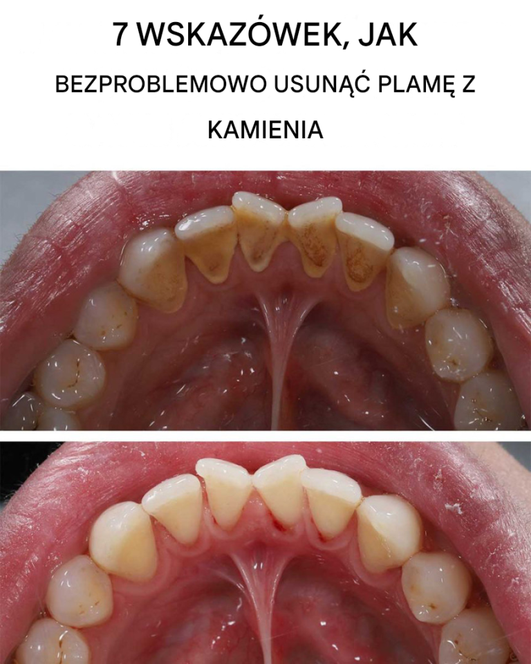 7 genialnych wskazówek, jak usunąć plamy z kamienia wapiennego