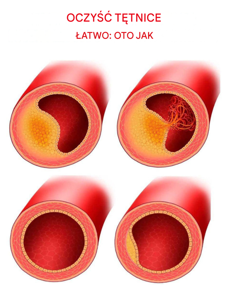 10 produktów, które powinieneś jeść codziennie, aby zachować zdrowe tętnice