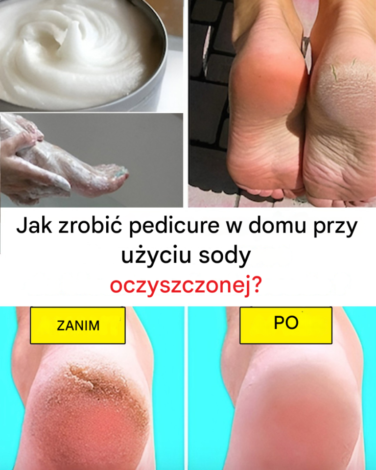 Jak zrobić pedicure w domu przy użyciu sody oczyszczonej?