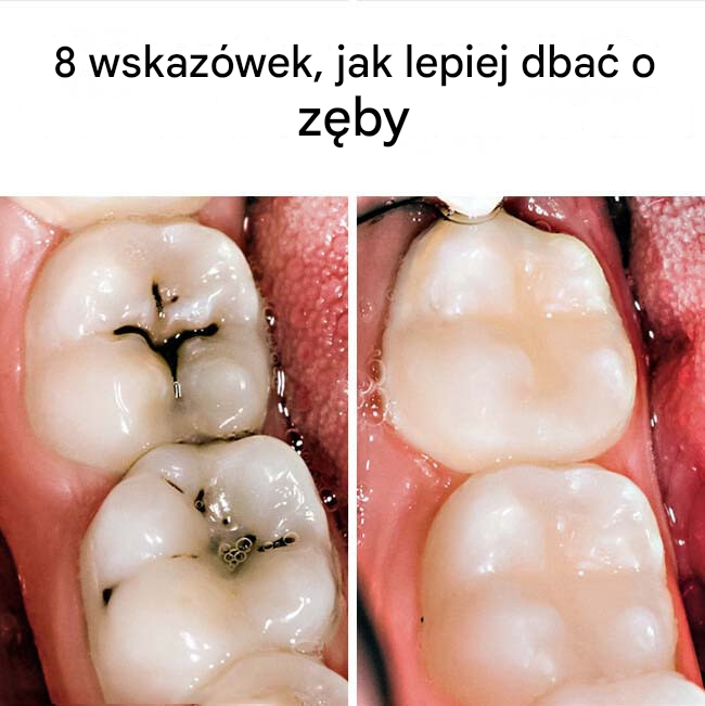8 wskazówek, jak lepiej dbać o zęby