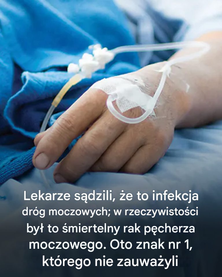Lekarze podejrzewali zakażenie dróg moczowych: okazało się, że to śmiertelny rak pęcherza moczowego. Oto znak nr 1, którego nie zauważyli