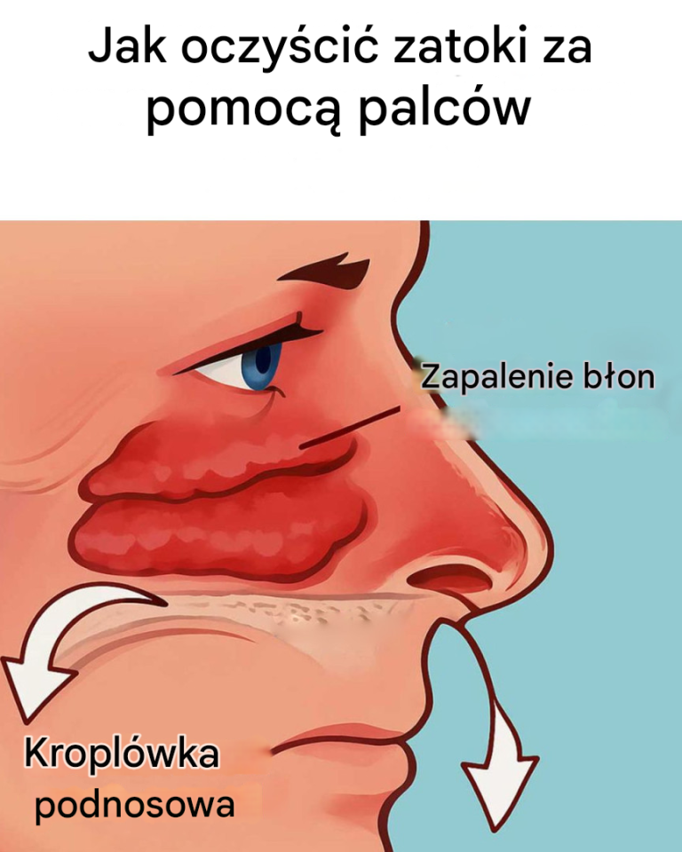 Jak oczyścić zatoki w sposób naturalny?