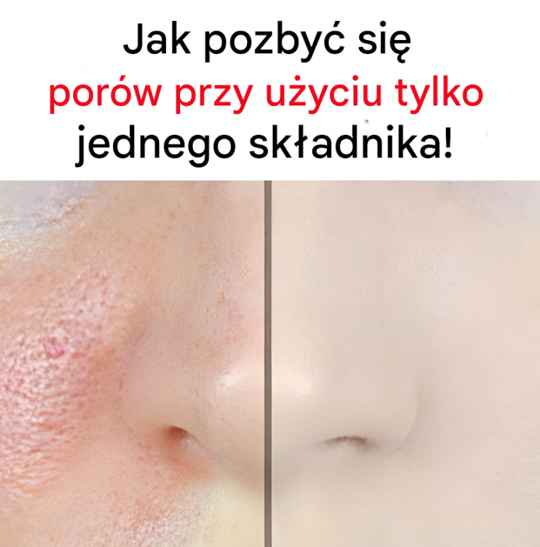 Jak ściągnąć rozszerzone pory?