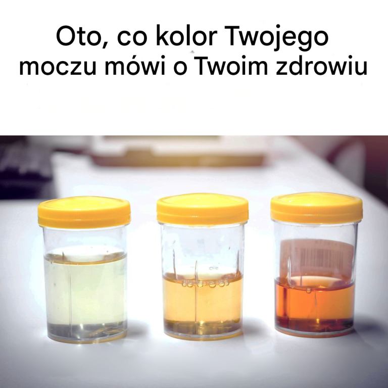 Oto, co kolor Twojego moczu mówi o Twoim zdrowiu