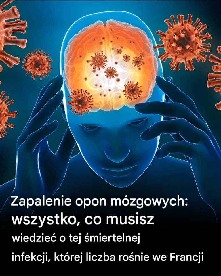 Zapalenie opon mózgowych: wszystko, co musisz wiedzieć o tej śmiertelnej infekcji, której liczba rośnie we Francji