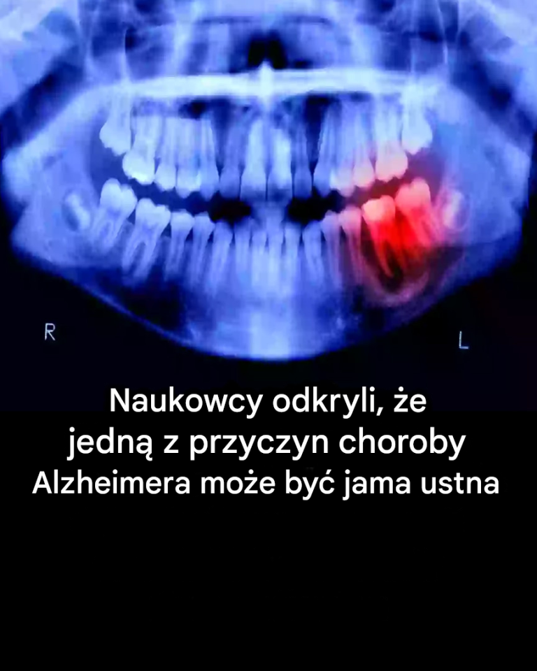 Powiązania między zdrowiem jamy ustnej a chorobą Alzheimera: nowa perspektywa naukowa