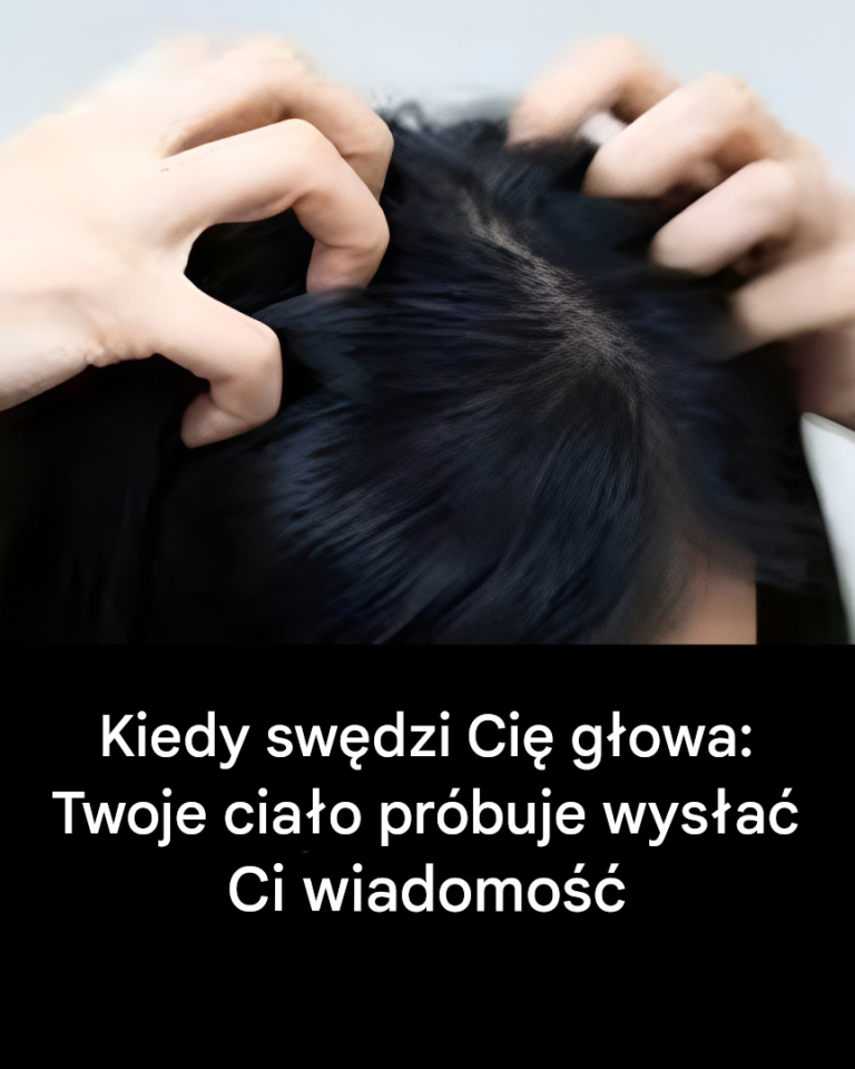 Swędząca głowa? Oto główne przyczyny
