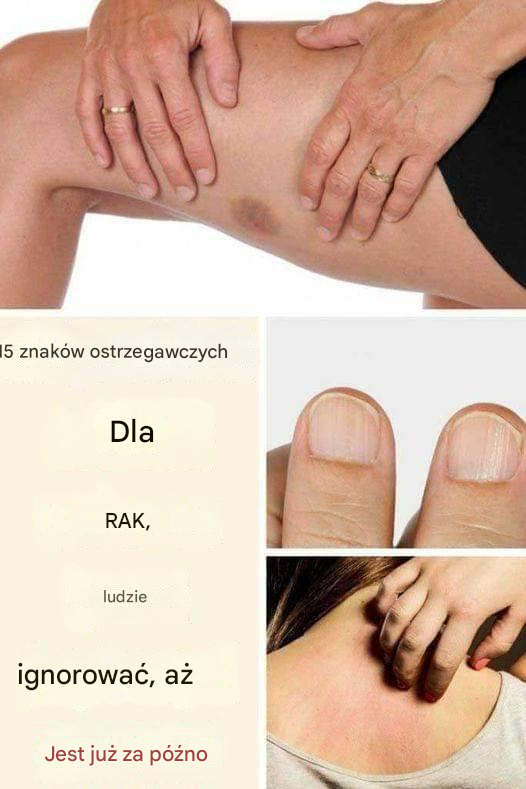 15 signes avant-coureurs du cancer que les gens ignorent jusqu’à ce qu’il soit trop tard.15 ostrzegawczych oznak raka, które ludzie ignorują, dopóki nie jest za późno