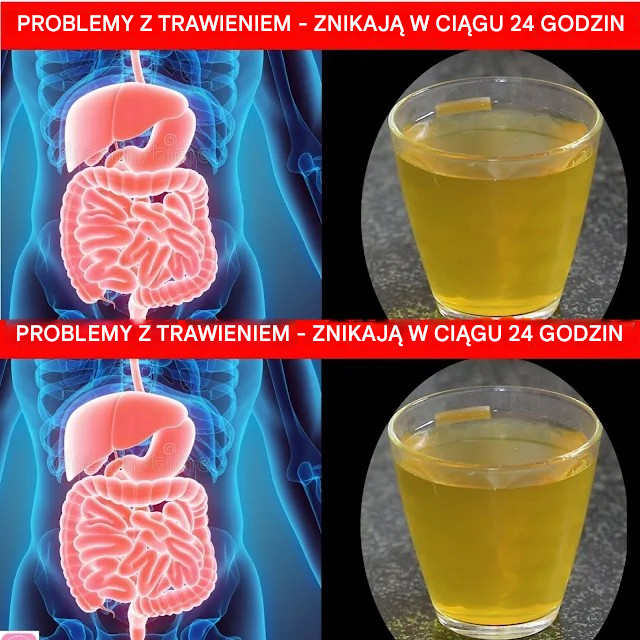 10 sposobów na poprawę układu trawiennego: natychmiastowe, naturalne wzmocnienie