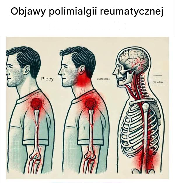 Sygnały ostrzegawcze wyniszczającej choroby zapalnej u osób starszych