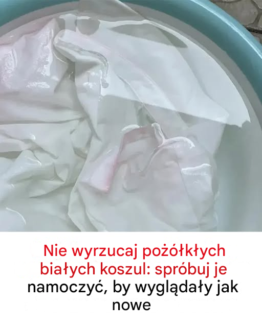 Oto dlaczego nie powinieneś wyrzucać pożółkłych białych koszul