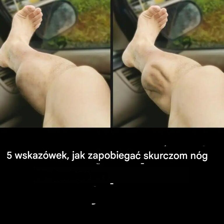 5 wskazówek, jak zapobiegać skurczom nóg