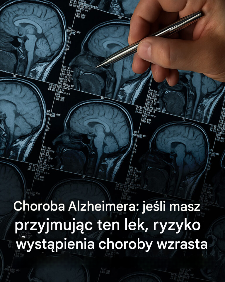 Choroba Alzheimera: zidentyfikowano 6 potencjalnych przyczyn i sposoby na zmniejszenie ich wpływu