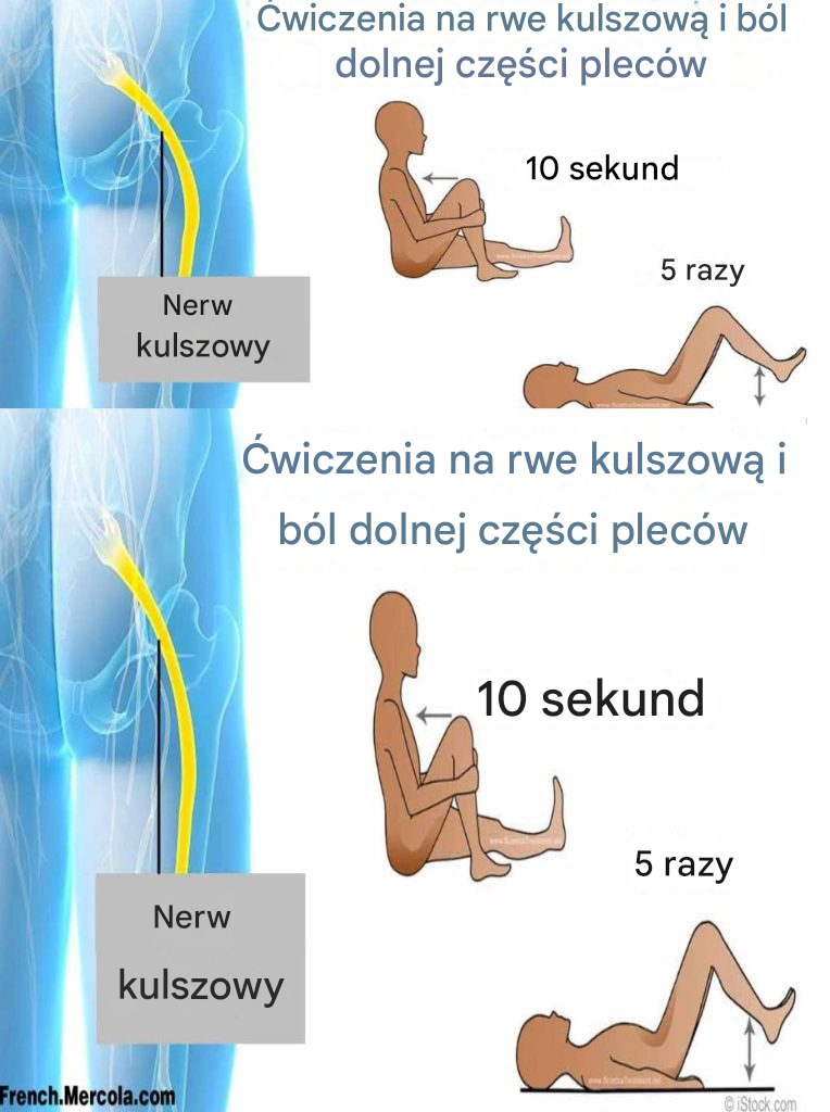 Ćwiczenia na rwę kulszową