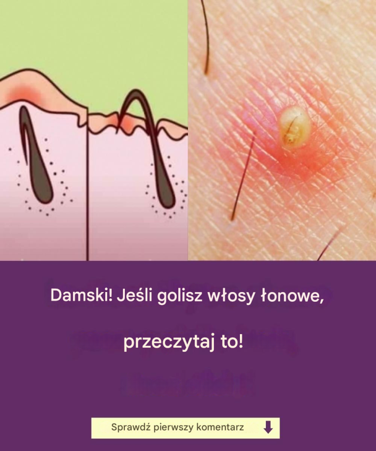 Panie! Jeśli golisz głowę publicznie, przeczytaj to!