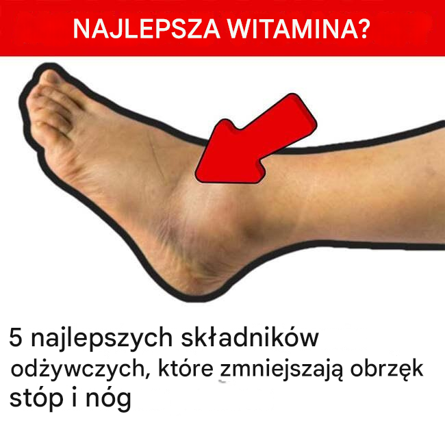 5 najlepszych składników odżywczych, które zmniejszają obrzęk stóp i nóg