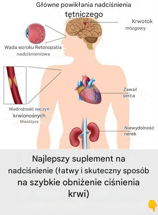 Najlepszy suplement na nadciśnienie (łatwy i skuteczny sposób na szybkie obniżenie ciśnienia krwi)