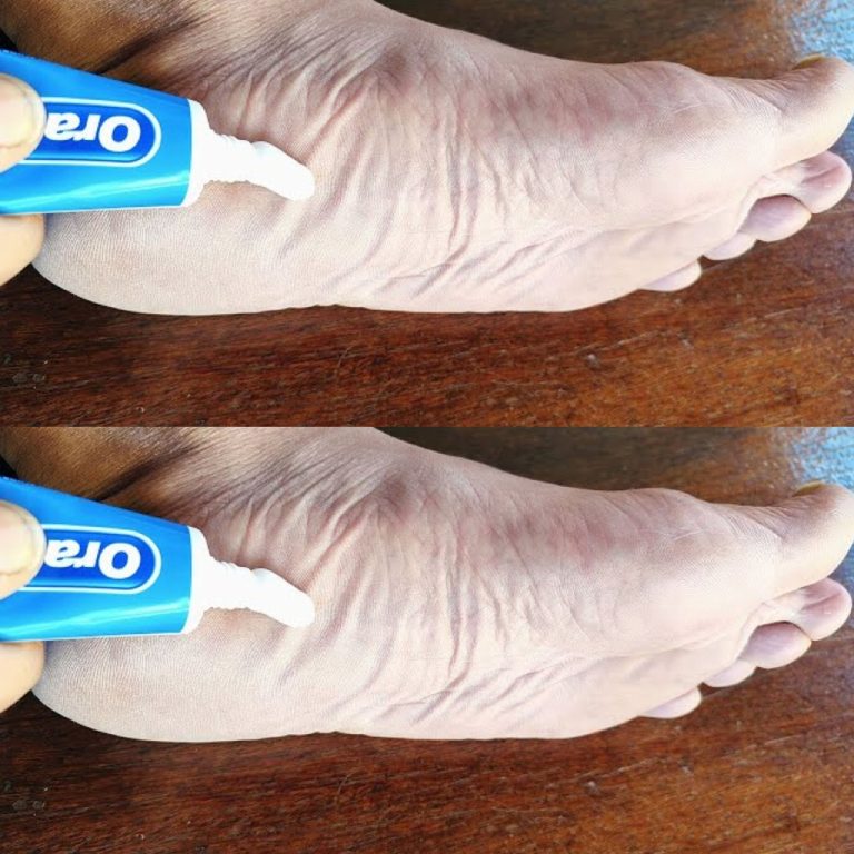Pasta do zębów dla Twoich stóp: zaskakujący domowy sposób