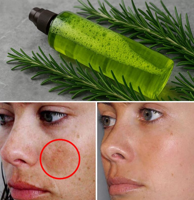 Tonik rozmarynowy do usuwania zmarszczek i plam skórnych