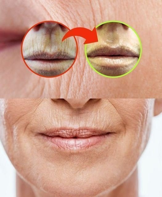 ZMARSZCZKI W USTACH, BRAK TRATY CZASU NA KREMY: ROZWIĄZANIE JEST W GABINECIE