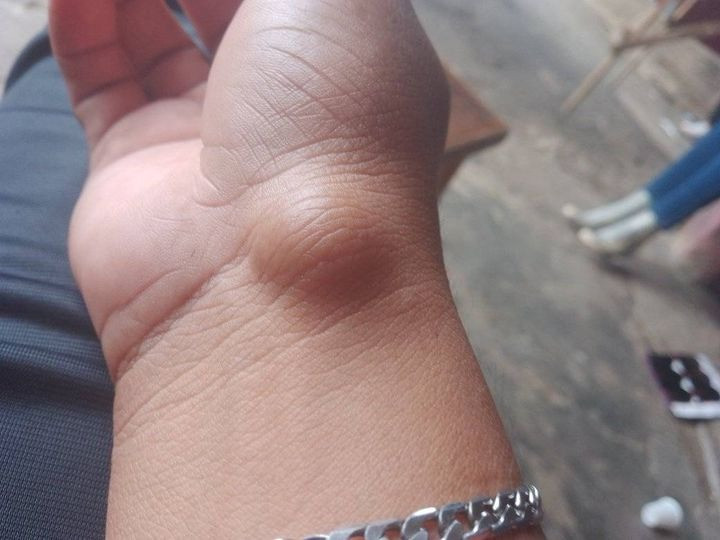 Tkanka tłuszczowa: system magazynowania energii w organizmie