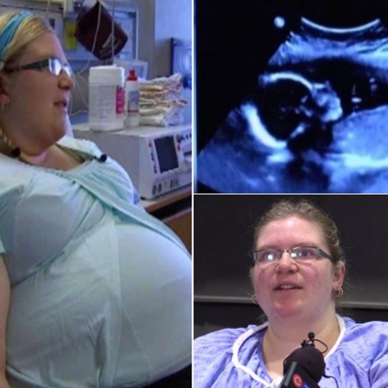 Para zszokowana badaniem USG – pielęgniarka mówi, że to przypadek 1 na 15 milionów