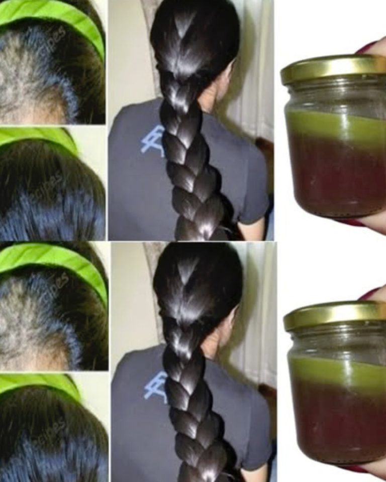 Indyjska sztuczka na szybki porost włosów i walkę z łysieniem.