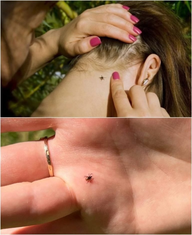 Już się obudziły. Co zrobić natychmiast, gdy ugryzie cię kleszcz!!