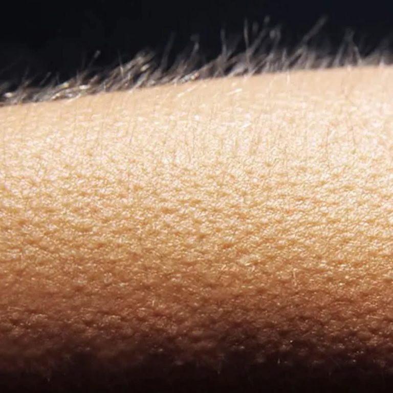 Dreszcze bez wyraźnego powodu? Dowiedz się, co twoje ciało może ci próbować powiedzieć.