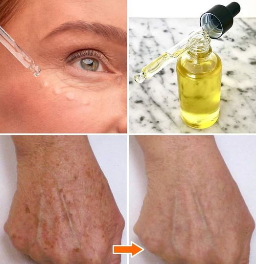 Ten olejek przeciwstarzeniowy usuwa zmarszczki i niedoskonałości skóry. Jest jednym z najczęściej stosowanych olejków na świecie.