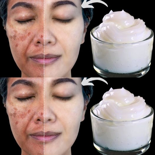 Cofnij się w czasie: Cudowna maseczka na twarz z mleka i skrobi kukurydzianej