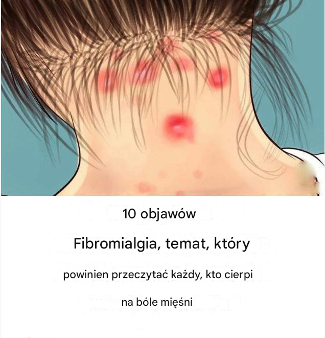 10 objawów fibromialgii, które każdy cierpiący na bóle mięśni powinien przeczytać